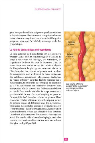 vaincre enfin la cellulite