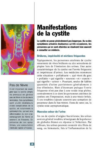 cystites et troubles urinaires